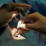 Cataract Surgery Cost in Australia