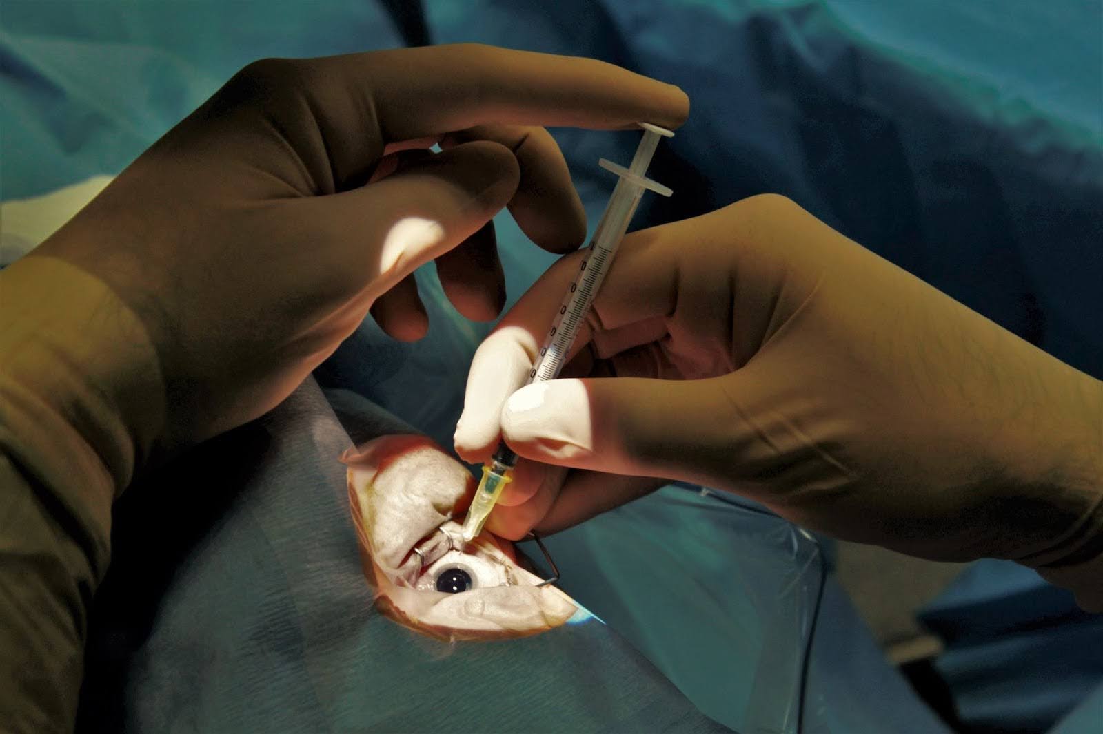 Cataract Surgery Cost in Australia
